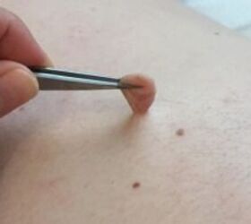 Moles and skin tags fall right off after doing this